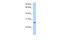 Zinc finger protein 176 antibody, PA5-69782, Invitrogen Antibodies, Western Blot image 