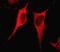 Integrin Linked Kinase antibody, ab76468, Abcam, Immunofluorescence image 