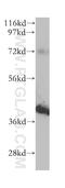 SHANK Associated RH Domain Interactor antibody, 14626-1-AP, Proteintech Group, Western Blot image 
