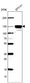 Cadherin 6 antibody, NBP1-90347, Novus Biologicals, Western Blot image 