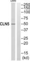 Ceroid-lipofuscinosis neuronal protein 5 antibody, abx014347, Abbexa, Western Blot image 