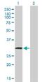 Tubulin Polyglutamylase Complex Subunit 2 antibody, H00025941-B01P, Novus Biologicals, Western Blot image 