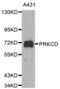 Protein Kinase C Delta antibody, abx000915, Abbexa, Western Blot image 