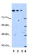 SET Domain Containing 2, Histone Lysine Methyltransferase antibody, ab69836, Abcam, Western Blot image 