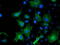 ADP Ribosylation Factor GTPase Activating Protein 1 antibody, LS-C172746, Lifespan Biosciences, Immunofluorescence image 