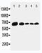 Paxillin antibody, LS-C312948, Lifespan Biosciences, Western Blot image 