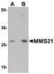 NSE2 (MMS21) Homolog, SMC5-SMC6 Complex SUMO Ligase antibody, PA5-20962, Invitrogen Antibodies, Western Blot image 