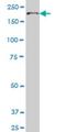 Ubiquitin Protein Ligase E3 Component N-Recognin 1 antibody, H00197131-M01, Novus Biologicals, Western Blot image 