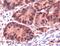 MutS Homolog 6 antibody, MA5-16381, Invitrogen Antibodies, Immunohistochemistry frozen image 