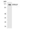 EPH Receptor A5 antibody, LS-C291928, Lifespan Biosciences, Western Blot image 