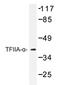 General Transcription Factor IIA Subunit 1 antibody, AP20422PU-N, Origene, Western Blot image 