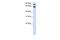 Dishevelled Segment Polarity Protein 2 antibody, PA5-40486, Invitrogen Antibodies, Western Blot image 