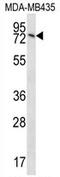 Sad1 And UNC84 Domain Containing 2 antibody, AP54462PU-N, Origene, Western Blot image 