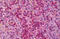 Interleukin 6 Receptor antibody, MBS244967, MyBioSource, Immunohistochemistry frozen image 