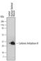 Carbonic Anhydrase 3 antibody, MAB2185, R&D Systems, Western Blot image 