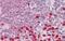 Prolyl 4-Hydroxylase Subunit Alpha 1 antibody, NB100-57852, Novus Biologicals, Immunohistochemistry paraffin image 