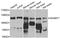 ADAM Metallopeptidase Domain 17 antibody, STJ22509, St John