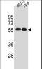 SRC Proto-Oncogene, Non-Receptor Tyrosine Kinase antibody, LS-C203762, Lifespan Biosciences, Western Blot image 