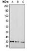 Regulator Of G Protein Signaling 20 antibody, LS-C353789, Lifespan Biosciences, Western Blot image 