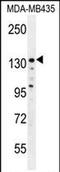 Zinc Finger E-Box Binding Homeobox 2 antibody, PA5-71628, Invitrogen Antibodies, Western Blot image 