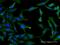 Splicing Factor 3b Subunit 2 antibody, H00010992-M10, Novus Biologicals, Immunocytochemistry image 