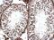 TANK Binding Kinase 1 antibody, PA5-34809, Invitrogen Antibodies, Immunohistochemistry frozen image 