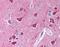 G Protein Subunit Alpha I1 antibody, orb86878, Biorbyt, Immunohistochemistry paraffin image 