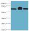 Citrin antibody, LS-C380265, Lifespan Biosciences, Western Blot image 