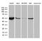 Alpha-aminoadipic semialdehyde dehydrogenase antibody, LS-C795815, Lifespan Biosciences, Western Blot image 