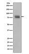 MYB Proto-Oncogene, Transcription Factor antibody, P00157, Boster Biological Technology, Western Blot image 