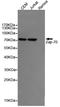 Zeta Chain Of T Cell Receptor Associated Protein Kinase 70 antibody, STJ99214, St John