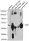 Carboxypeptidase B antibody, A08101, Boster Biological Technology, Western Blot image 
