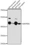 Ectonucleoside Triphosphate Diphosphohydrolase 6 antibody, A15655, ABclonal Technology, Western Blot image 