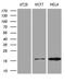 Anterior Gradient 2, Protein Disulphide Isomerase Family Member antibody, LS-C795144, Lifespan Biosciences, Western Blot image 