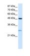 Chloride Intracellular Channel 4 antibody, orb329819, Biorbyt, Western Blot image 