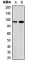 Calpain 3 antibody, orb234780, Biorbyt, Western Blot image 