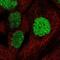 Small Ubiquitin Like Modifier 1 antibody, NBP2-54916, Novus Biologicals, Immunofluorescence image 