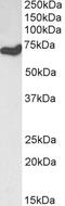 SET Domain Bifurcated Histone Lysine Methyltransferase 2 antibody, 42-978, ProSci, Western Blot image 