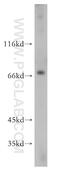 Solute Carrier Family 27 Member 2 antibody, 14048-1-AP, Proteintech Group, Western Blot image 