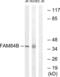 LRAT Domain Containing 2 antibody, abx013763, Abbexa, Western Blot image 