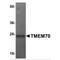 Transmembrane Protein 70 antibody, MBS150162, MyBioSource, Western Blot image 