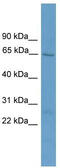 Acyl-CoA Thioesterase 11 antibody, TA333492, Origene, Western Blot image 