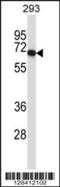 Protein Disulfide Isomerase Like, Testis Expressed antibody, 57-117, ProSci, Western Blot image 