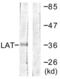 Linker For Activation Of T Cells antibody, LS-C117752, Lifespan Biosciences, Western Blot image 