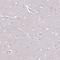 C-X-C chemokine receptor type 5 antibody, HPA042432, Atlas Antibodies, Immunohistochemistry frozen image 