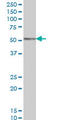 Coronin 1A antibody, LS-B6211, Lifespan Biosciences, Western Blot image 