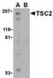 TSC Complex Subunit 2 antibody, NBP1-76430, Novus Biologicals, Western Blot image 