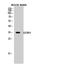 Insulin Like Growth Factor Binding Protein 3 antibody, STJ93651, St John