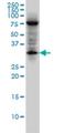 Ectodysplasin A2 Receptor antibody, H00060401-M02, Novus Biologicals, Western Blot image 