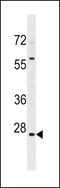 High Mobility Group Nucleosome Binding Domain 5 antibody, 59-144, ProSci, Western Blot image 